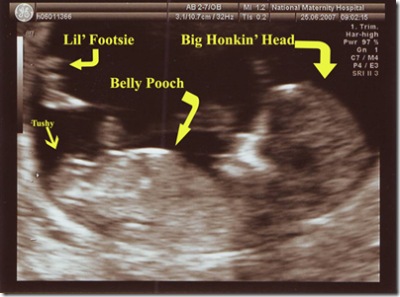 Baby - 12 weeks - with labels